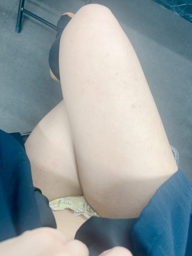 むっちむち！